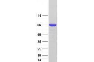 Western Blotting (WB) image for CTP Synthase II (CTPS2) (Transcript Variant 1) protein (Myc-DYKDDDDK Tag) (ABIN2712616)