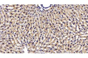 Immunohistochemistry (IHC) image for anti-Insulin-Degrading Enzyme (IDE) (AA 753-973) antibody (ABIN7434305)