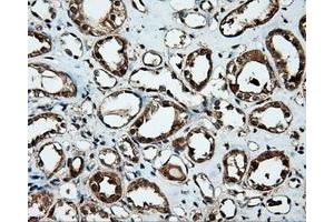 Immunohistochemical staining of paraffin-embedded Kidney tissue using anti-MTRF1L mouse monoclonal antibody. (MTRF1L 抗体)