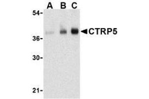 Western blot analysis of CTRP5 in human brain cell lysate with AP30254PU-N CTRP5 antibody at (A) 1, (B) 2, and (C) 4 μg/ml. (CTRP5 抗体  (N-Term))