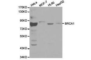 Western Blotting (WB) image for anti-Breast Cancer 1 (BRCA1) antibody (ABIN1871342) (BRCA1 抗体)