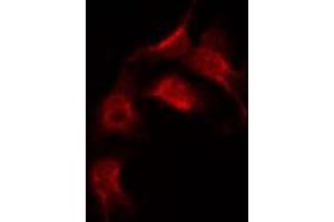 ABIN6267383 staining 293 by IF/ICC. (Ezrin 抗体  (pThr567))