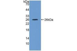 Detection of Recombinant IL4R, Rat using Polyclonal Antibody to Interleukin 4 Receptor (IL4R) (IL4 Receptor 抗体  (AA 26-232))