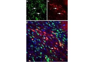 Expression of Neuropilin-2 in mouse substantia nigra pars compacta - Immunohistochemical staining of perfusion-fixed frozen mouse brain sections using Anti-Neuropilin-2 (NRP2) (extracellular) Antibody (ABIN7043380, ABIN7044700 and ABIN7044701), (1:400). (NRP2 抗体  (Extracellular, N-Term))
