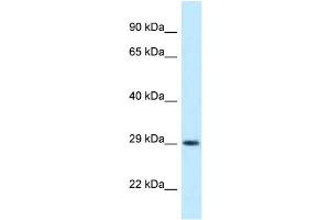 WB Suggested Anti-Olig1 Antibody Titration: 1. (OLIG1 抗体  (Middle Region))