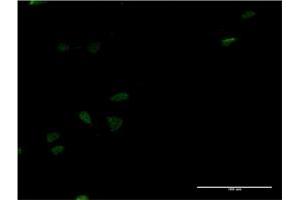 Immunofluorescence of monoclonal antibody to LEF1 on HeLa cell. (LEF1 抗体  (AA 33-138))