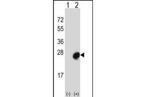 Western blot analysis of MID1IP1 (arrow) using rabbit polyclonal MID1IP1 Antibody (N-term) (ABIN656689 and ABIN2845926). (m1ip1 抗体  (N-Term))