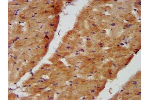 IHC image of ABIN7160937 diluted at 1:400 and staining in paraffin-embedded human heart tissue performed on a Leica BondTM system.