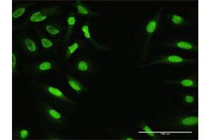 Immunofluorescence of purified MaxPab antibody to ZNF124 on HeLa cell. (ZNF124 抗体  (AA 1-289))