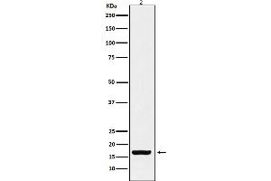 anti-H3C1 (H3K18ac) antibody