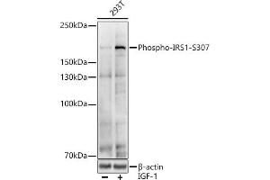 Western blot analysis of extracts of various cell lines, using Phospho-IRS1-S307 antibody (ABIN6135245, ABIN6136114, ABIN6136115 and ABIN6225577) at 1:1000 dilution. (IRS1 抗体  (pSer307))