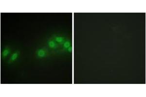 Immunofluorescence analysis of HepG2 cells, using LATS2 Antibody. (LATS2 抗体  (AA 541-590))