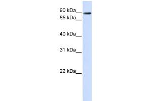 WB Suggested Anti-TMEM16K Antibody Titration:  0. (Anoctamin 10 抗体  (C-Term))