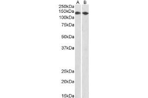 ABIN2561628 (0. (CCAR2 抗体  (AA 842-855))