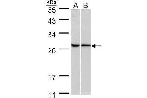WB Image Sample (30 ug of whole cell lysate) A:293T B:HeLa 10% SDS PAGE antibody diluted at 1:500 (RPL13A 抗体)