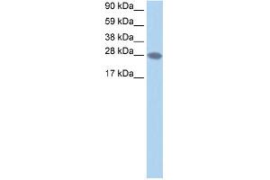 WB Suggested Anti-TCEA2 Antibody Titration:  1. (TCEA2 抗体  (N-Term))