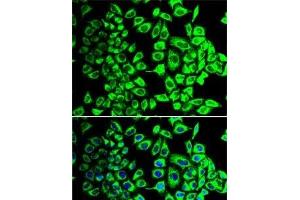 Immunofluorescence analysis of HeLa cells using SDHA Polyclonal Antibody (SDHA 抗体)