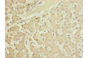 Immunohistochemistry of paraffin-embedded human liver tissue using ABIN7165639 at dilution of 1:100 (HOOK2 抗体  (AA 440-719))