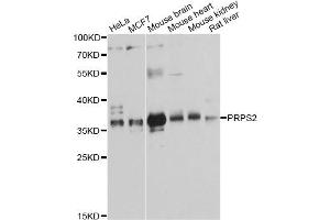 Western blot analysis of extracts of various cell lines, using PRPS2 antibody. (PRPS2 抗体)