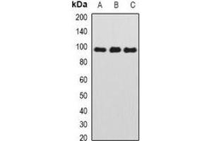 Western blot analysis of TAFI110 expression in HEK293T (A), MCF7 (B), mouse thymus (C) whole cell lysates. (TAF1C 抗体)