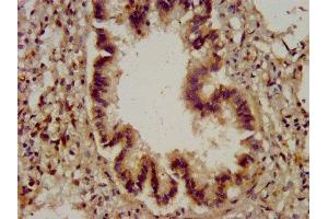 IHC image of ABIN7149098 diluted at 1:200 and staining in paraffin-embedded human lung tissue performed on a Leica BondTM system. (CYBA 抗体  (AA 128-195))