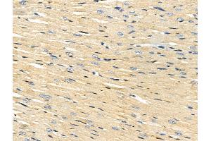 ABIN7093197 and ABIN7097208 at 1/100 staining Rat heart tissue by IHC-P. (ACSS1 抗体)