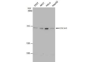 WB Image COL3A1 antibody [C2C3], C-term detects COL3A1 protein by western blot analysis. (COL3A1 抗体  (C-Term))