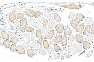 Immunohistochemistry (IHC) image for anti-Protein Kinase, AMP-Activated, alpha 1 Catalytic Subunit (PRKAA1) (AA 350-400) antibody (ABIN7453592)