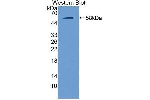 Western Blotting (WB) image for anti-Glucosidase, Beta, Acid (GBA) (AA 255-509) antibody (ABIN1858967) (GBA 抗体  (AA 255-509))