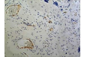 Immunohistochemistry (IHC) image for anti-Basal Cell Adhesion Molecule (Lutheran Blood Group) (BCAM) (AA 32-547) antibody (ABIN1983020)