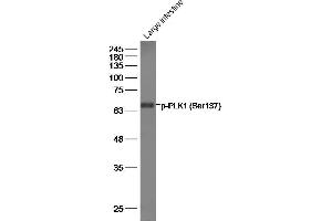 Mouse large intestine lysates, probed with PLK1 (Ser137) Polyclonal Antibody, unconjugated at 1:500 overnight at 4°C followed by a conjugated secondary antibody for 60 minutes at 37°C. (PLK1 抗体  (pSer137))