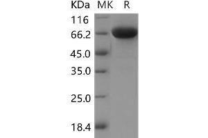 IGSF8 Protein (His tag)