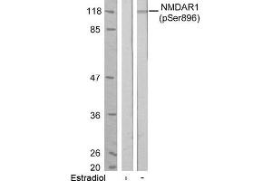 Image no. 1 for anti-NMDA Receptor 1 (NMDA R1) (pSer896) antibody (ABIN196794) (NMDA 1 Receptor 抗体  (pSer896))
