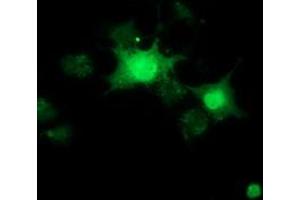 Anti-RBBP9 mouse monoclonal antibody (ABIN2453593) immunofluorescent staining of COS7 cells transiently transfected by pCMV6-ENTRY RBBP9 (RC202090). (RBBP9 抗体)