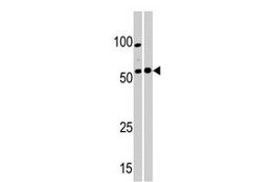 Western blot analysis of PKMYT1 polyclonal antibody  in A-375 (left) and Y-79 (right) cell line lysate. (PKMYT1 抗体  (C-Term))