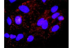Proximity Ligation Analysis of protein-protein interactions between AKT1 and CDKN1A. (AKT1 抗体  (AA 1-480))