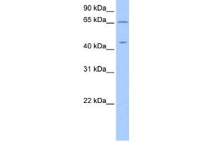 WB Suggested Anti-ZPLD1 Antibody Titration: 0. (ZPLD1 抗体  (C-Term))