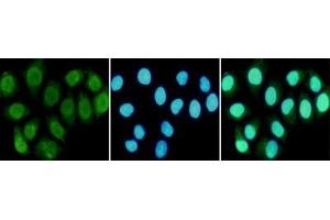 Immunocytochemistry staining of HeLa cells fixed in 1 % Paraformaldehyde and using R mouse mAb (dilution 1:100). (RPA1 抗体)