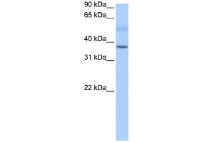 WB Suggested Anti-SERTAD2 Antibody Titration:  0. (SERTAD2 抗体  (N-Term))