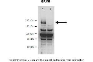 Lanes:   Lane1: 10 ug WT mouse retina lysate Lane2: 10 ug GRM6 knockout mouse retina lysate  Primary Antibody Dilution:   1:1000  Secondary Antibody:   Anti-rabbit HRP  Secondary Antibody Dilution:   1:10000  Gene Name:   GRM6  Submitted by:   Anonymous