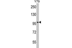 Western Blotting (WB) image for anti-Karyopherin (Importin) beta 1 (KPNB1) antibody (ABIN3002817) (KPNB1 抗体)