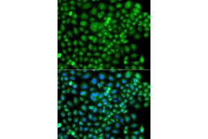 Immunofluorescence analysis of A549 cells using SUMO4 antibody (ABIN5975591). (SUMO4 抗体)