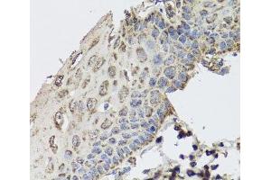 Immunohistochemistry of paraffin-embedded Human esophagus using GBF1 Polyclonal Antibody at dilution of 1:100 (40x lens). (GBF1 抗体)