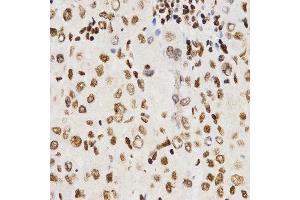 Immunohistochemistry (IHC) image for anti-Histone 3 (H3) (C-Term) antibody (ABIN3023243)