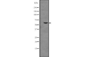 Western blot analysis of Cytochrome P450 17A1 expression in K562 cell line lysates ,The lane on the left is treated with the antigen-specific peptide. (CYP17A1 抗体  (Internal Region))