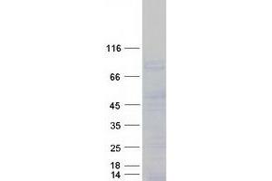 Western Blotting (WB) image for SPARC Related Modular Calcium Binding 1 (SMOC1) (Transcript Variant 1) protein (Myc-DYKDDDDK Tag) (ABIN2732254)