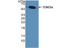 Detection of Recombinant PSMC1, Human using Polyclonal Antibody to Proteasome 26S Subunit, ATPase 1 (PSMC1) (PSMC1 抗体  (AA 1-440))