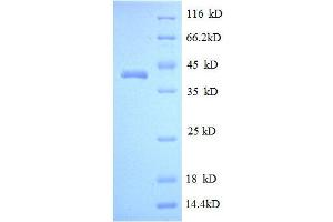 MPZ (AA 30-156), (partial) protein (GST tag) (MPZ Protein (AA 30-156, partial) (GST tag))