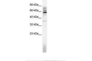 Image no. 1 for anti-TAF15 RNA Polymerase II, TATA Box Binding Protein (TBP)-Associated Factor, 68kDa (TAF15) (AA 183-232) antibody (ABIN202793) (TAF15 抗体  (AA 183-232))