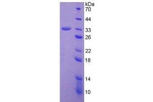 SDS-PAGE analysis of Human ADAM28 Protein. (ADAM28 蛋白)
